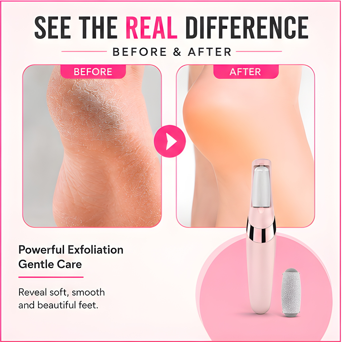 Electric Pedicure Foot File Callus Remover