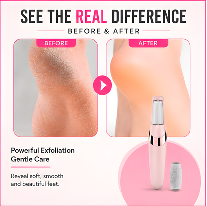 Electric Pedicure Foot File Callus Remover