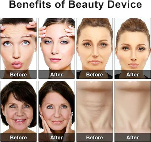 Eye Beauty Device - TheFindsByAzlan