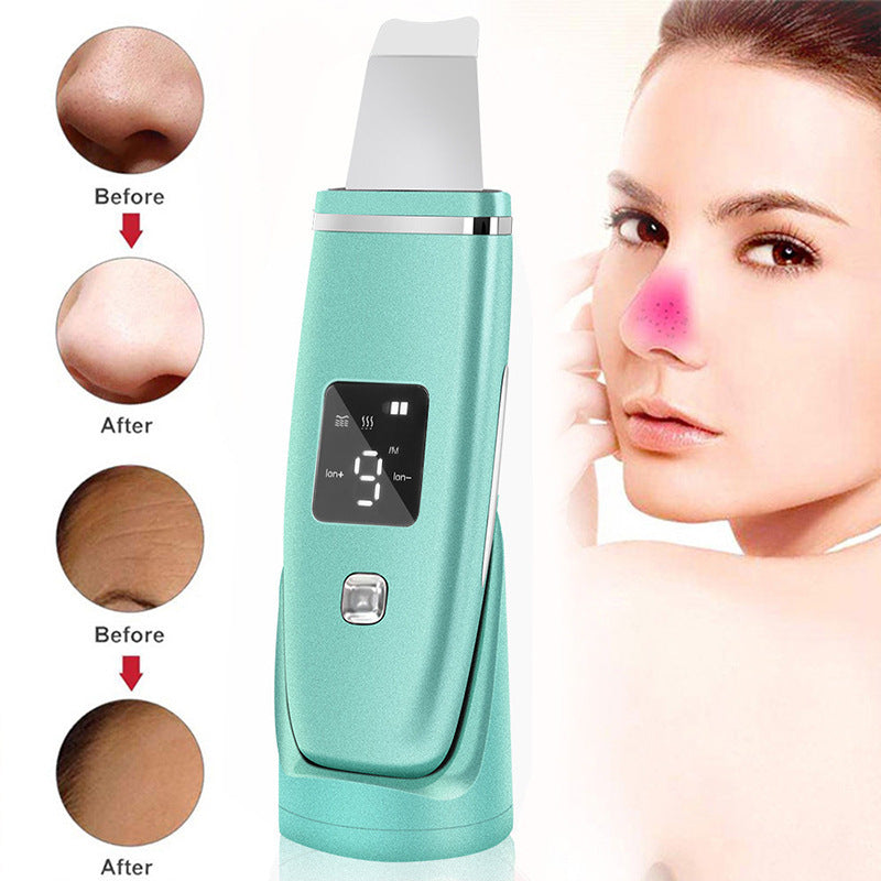 Ultrasonic Vibration Blackhead Remover - TheFindsByAzlan